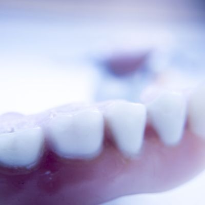 Prosthetic dental partial dentures